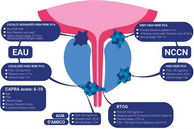 Therapeutic Sequences in the Treatment of High-Risk Prostate Cancer: Paving the Way Towards Multimodal Tailored Approaches